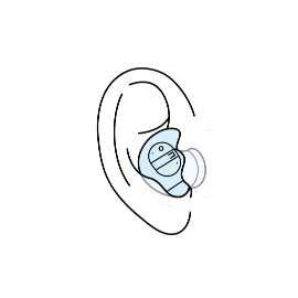 In-the-ear hearing aid illustration
